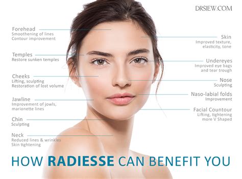 radiesse queensland|Radiesse: What It's Made Of, How Long It Lasts, .